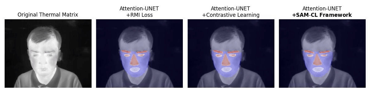 SAMCL Demo